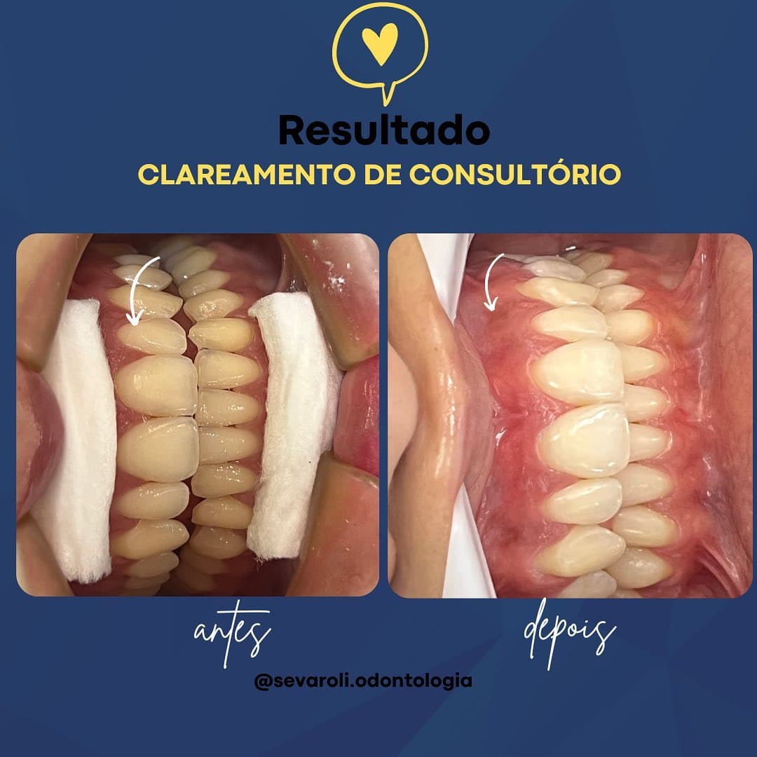 CLAREAMENTO DE CONSULTÓRIO